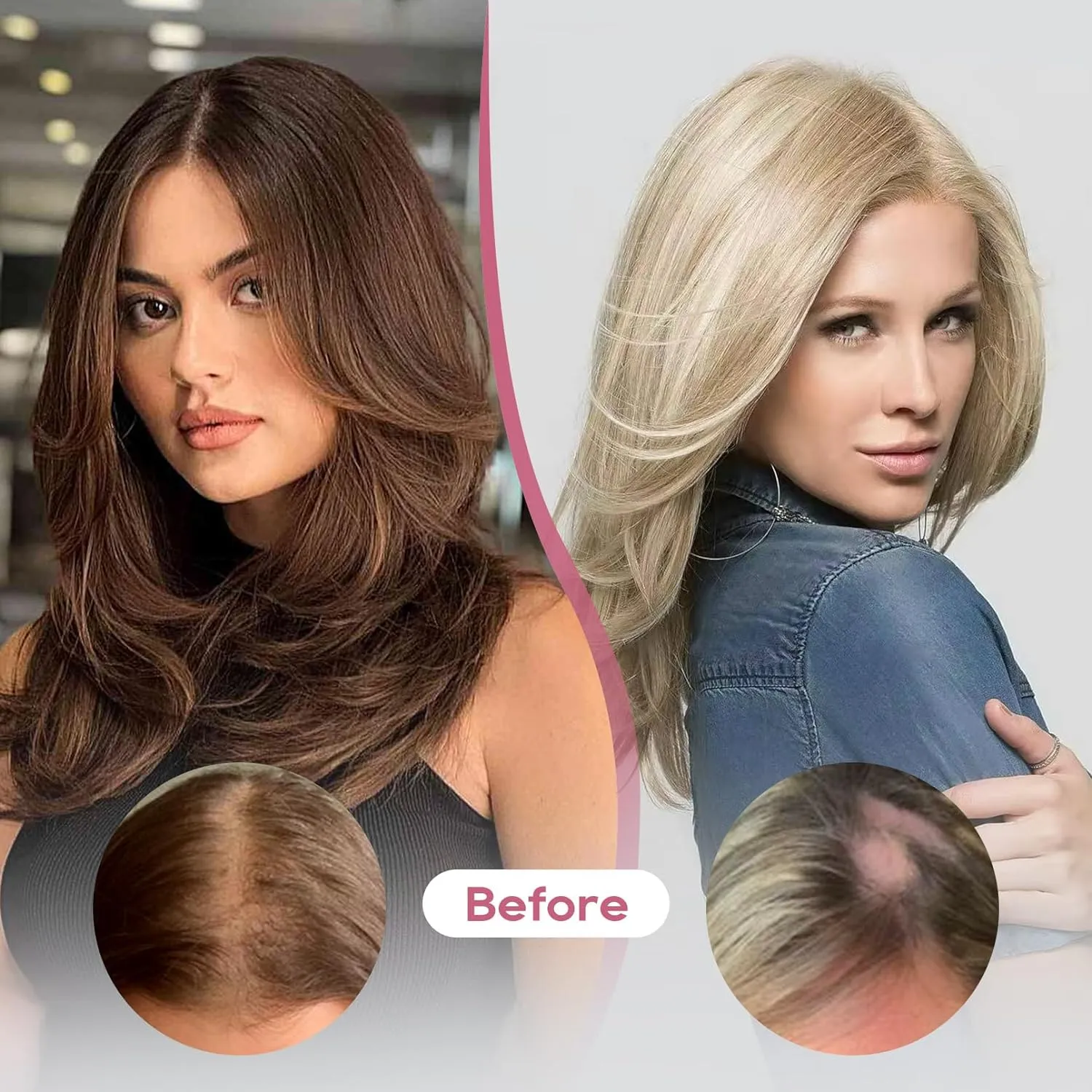 REECHO Human Hair Topper, 10 Inch Hair Toppers for Women Real Human Hair, Real Human Wiglet Adding Targeted Coverage for Thinning Hair, Medium Brown
